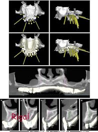 Equipo de diagnóstico